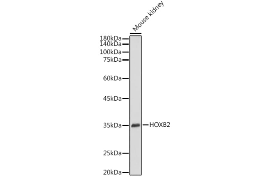 Western Blot - Anti-HOXB2 Antibody (A305784) - Antibodies.com