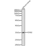 Western Blot - Anti-HOXB2 Antibody (A305784) - Antibodies.com