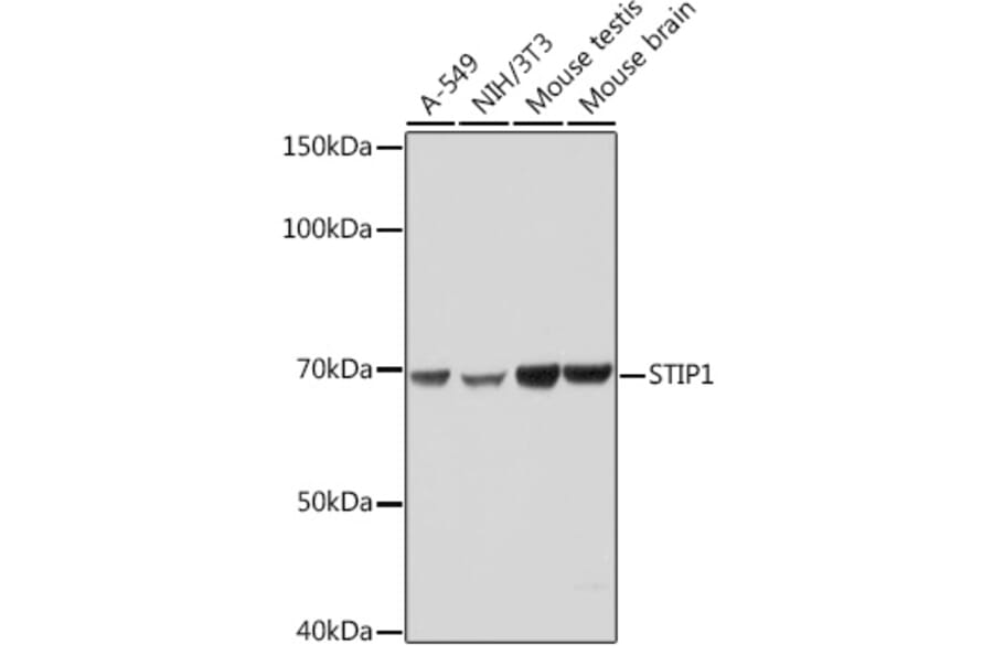 Western Blot - Anti-STIP1/STI1 Antibody [ARC1805] (A305785) - Antibodies.com