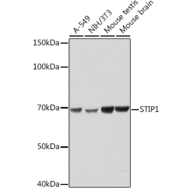 Western Blot - Anti-STIP1/STI1 Antibody [ARC1805] (A305785) - Antibodies.com