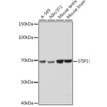 Western Blot - Anti-STIP1/STI1 Antibody [ARC1805] (A305785) - Antibodies.com