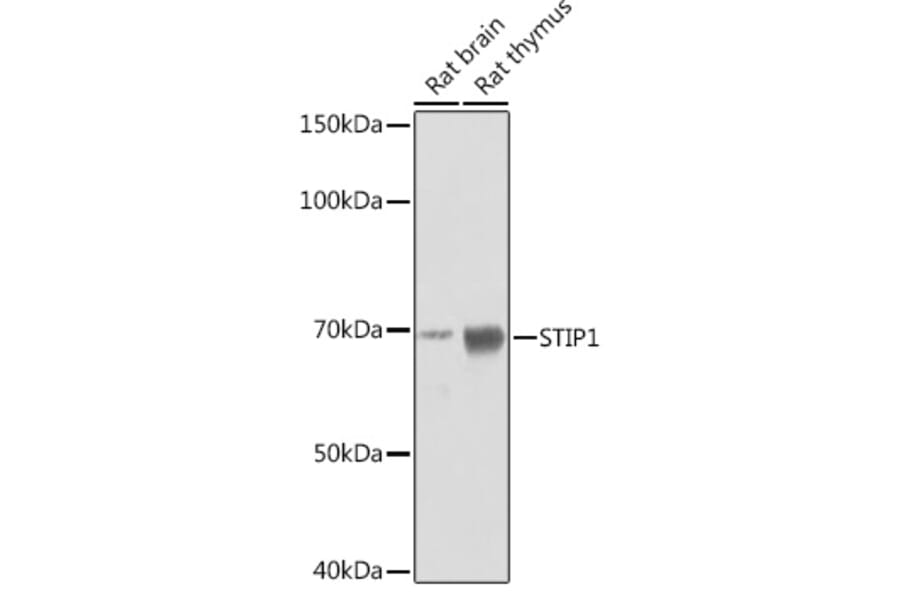 Western Blot - Anti-STIP1/STI1 Antibody [ARC1805] (A305785) - Antibodies.com