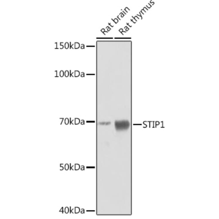 Western Blot - Anti-STIP1/STI1 Antibody [ARC1805] (A305785) - Antibodies.com