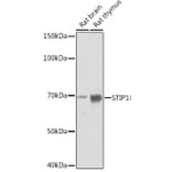 Western Blot - Anti-STIP1/STI1 Antibody [ARC1805] (A305785) - Antibodies.com