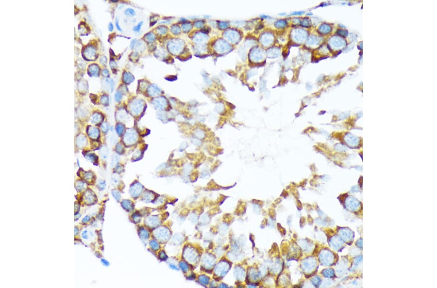 Immunohistochemistry - Anti-STIP1/STI1 Antibody [ARC1805] (A305785) - Antibodies.com