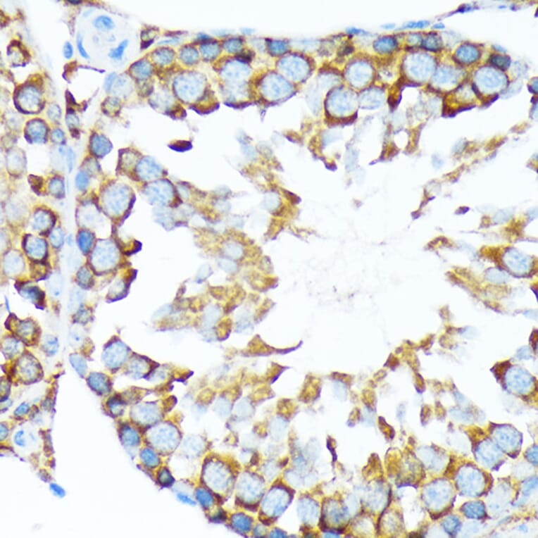 Immunohistochemistry - Anti-STIP1/STI1 Antibody [ARC1805] (A305785) - Antibodies.com