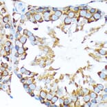 Immunohistochemistry - Anti-STIP1/STI1 Antibody [ARC1805] (A305785) - Antibodies.com