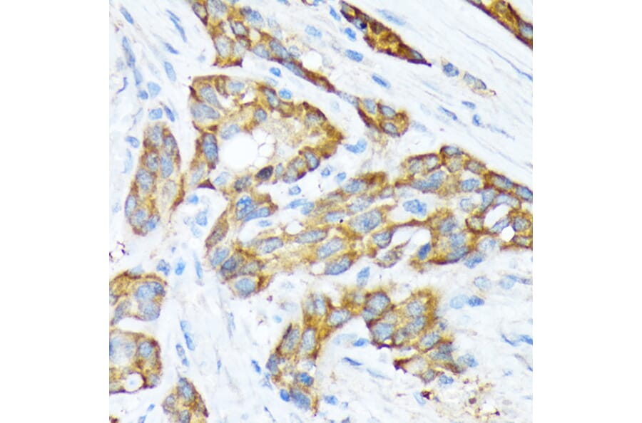 Immunohistochemistry - Anti-STIP1/STI1 Antibody [ARC1805] (A305785) - Antibodies.com