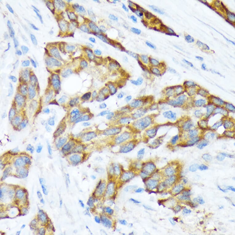 Immunohistochemistry - Anti-STIP1/STI1 Antibody [ARC1805] (A305785) - Antibodies.com