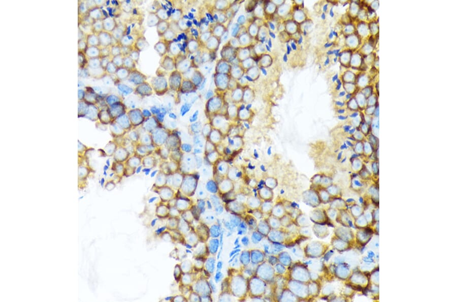 Immunohistochemistry - Anti-STIP1/STI1 Antibody [ARC1805] (A305785) - Antibodies.com