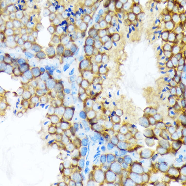 Immunohistochemistry - Anti-STIP1/STI1 Antibody [ARC1805] (A305785) - Antibodies.com