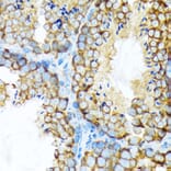 Immunohistochemistry - Anti-STIP1/STI1 Antibody [ARC1805] (A305785) - Antibodies.com