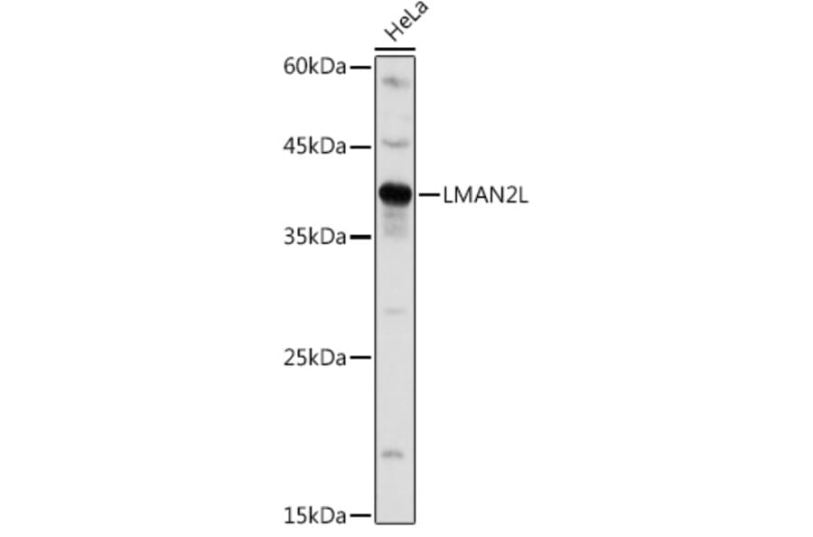Western Blot - Anti-LMAN2L Antibody (A305786) - Antibodies.com