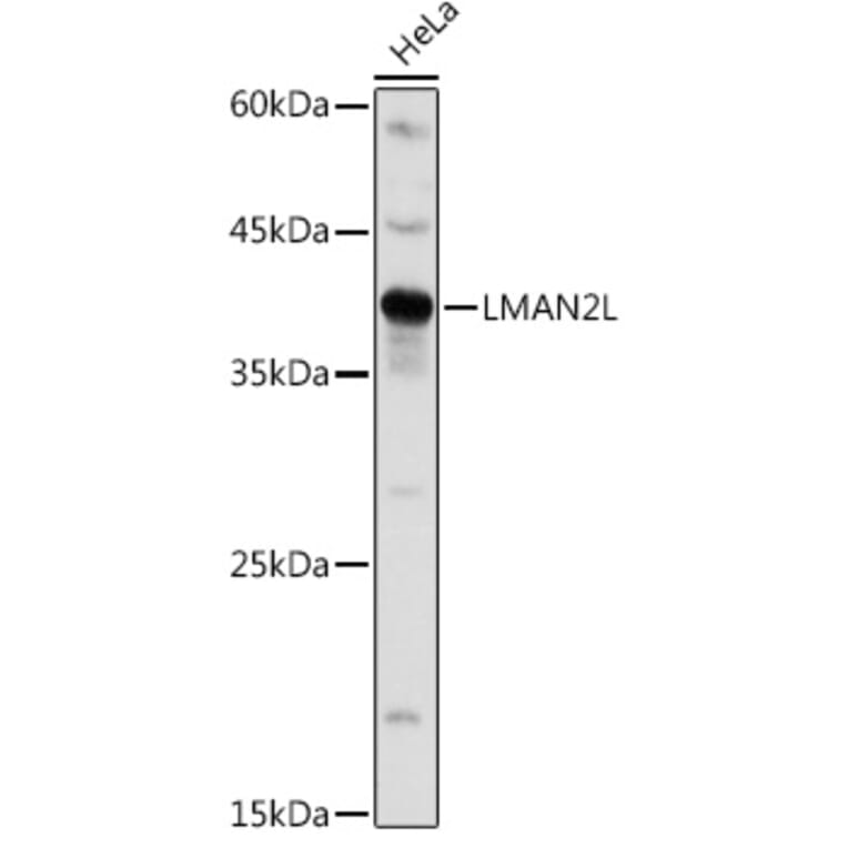 Western Blot - Anti-LMAN2L Antibody (A305786) - Antibodies.com