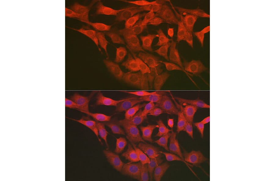 Immunofluorescence - Anti-LMAN2L Antibody (A305786) - Antibodies.com
