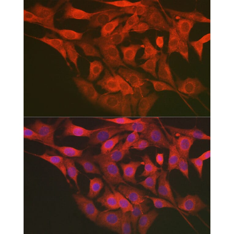 Immunofluorescence - Anti-LMAN2L Antibody (A305786) - Antibodies.com