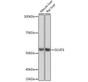 Western Blot - Anti-GLUD1 Antibody [ARC1216] (A305787) - Antibodies.com
