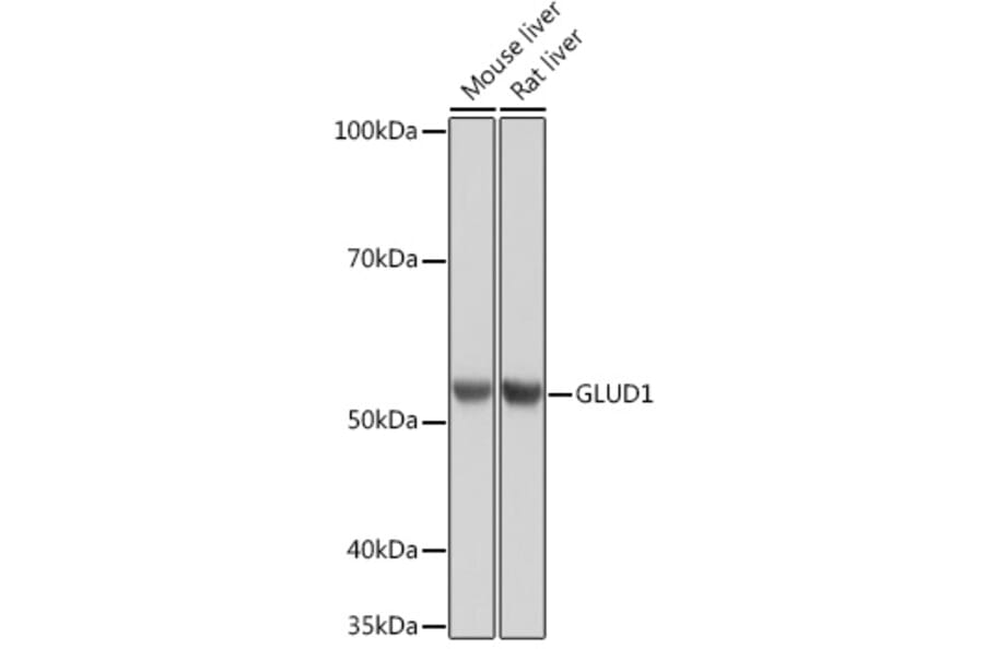 Western Blot - Anti-GLUD1 Antibody [ARC1216] (A305787) - Antibodies.com