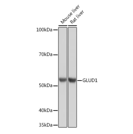 Western Blot - Anti-GLUD1 Antibody [ARC1216] (A305787) - Antibodies.com