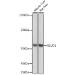 Western Blot - Anti-GLUD1 Antibody [ARC1216] (A305787) - Antibodies.com
