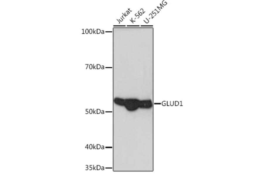 Western Blot - Anti-GLUD1 Antibody [ARC1216] (A305787) - Antibodies.com