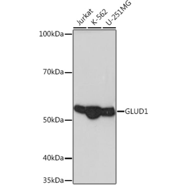Western Blot - Anti-GLUD1 Antibody [ARC1216] (A305787) - Antibodies.com