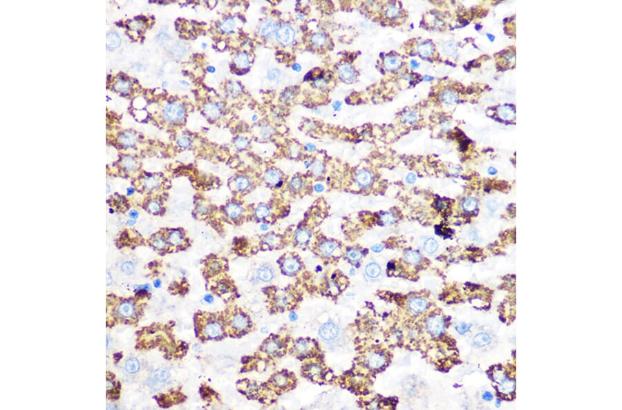Immunohistochemistry - Anti-GLUD1 Antibody [ARC1216] (A305787) - Antibodies.com