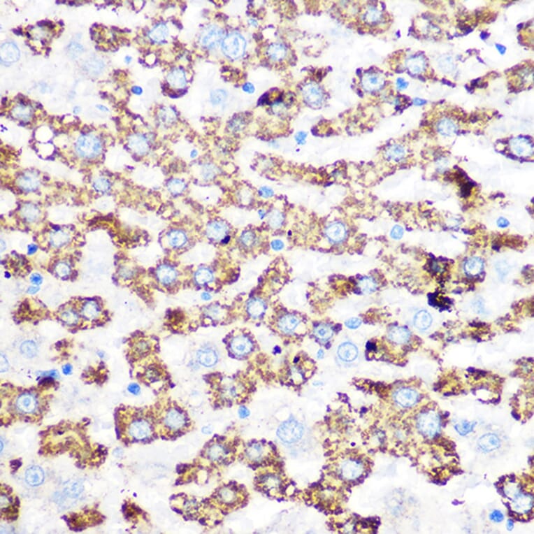 Immunohistochemistry - Anti-GLUD1 Antibody [ARC1216] (A305787) - Antibodies.com