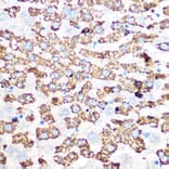 Immunohistochemistry - Anti-GLUD1 Antibody [ARC1216] (A305787) - Antibodies.com