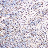 Immunohistochemistry - Anti-GLUD1 Antibody [ARC1216] (A305787) - Antibodies.com