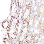 Immunohistochemistry - Anti-GLUD1 Antibody [ARC1216] (A305787) - Antibodies.com