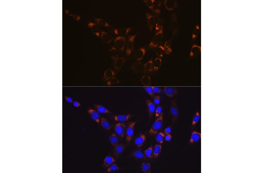 Immunofluorescence - Anti-GLUD1 Antibody [ARC1216] (A305787) - Antibodies.com