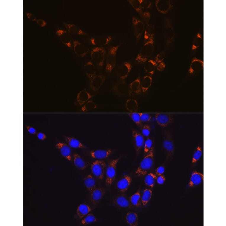 Immunofluorescence - Anti-GLUD1 Antibody [ARC1216] (A305787) - Antibodies.com