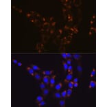 Immunofluorescence - Anti-GLUD1 Antibody [ARC1216] (A305787) - Antibodies.com