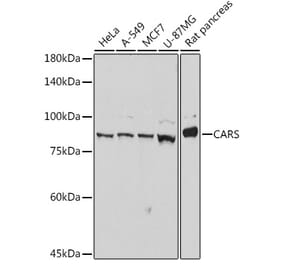Western Blot - Anti-CARS Antibody [ARC2504] (A305788) - Antibodies.com
