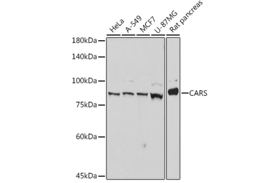 Western Blot - Anti-CARS Antibody [ARC2504] (A305788) - Antibodies.com