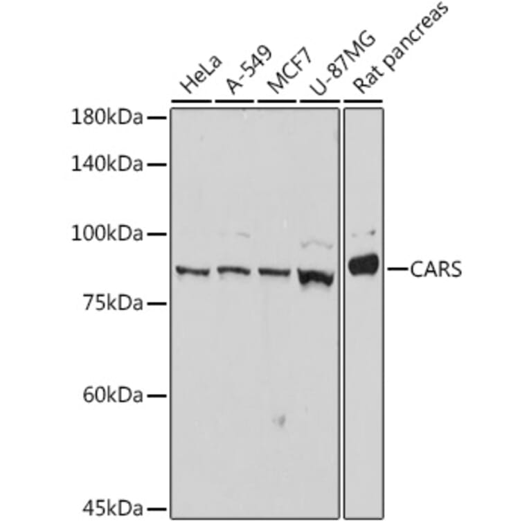 Western Blot - Anti-CARS Antibody [ARC2504] (A305788) - Antibodies.com