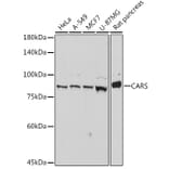 Western Blot - Anti-CARS Antibody [ARC2504] (A305788) - Antibodies.com