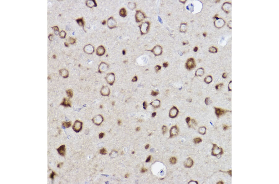 Immunohistochemistry - Anti-CARS Antibody [ARC2504] (A305788) - Antibodies.com