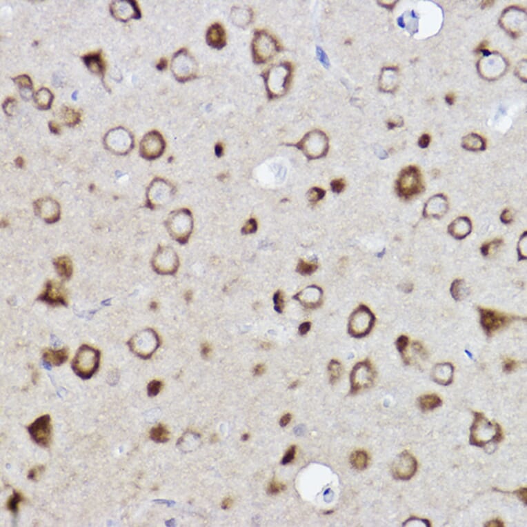 Immunohistochemistry - Anti-CARS Antibody [ARC2504] (A305788) - Antibodies.com
