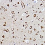Immunohistochemistry - Anti-CARS Antibody [ARC2504] (A305788) - Antibodies.com