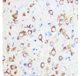 Immunohistochemistry - Anti-Mint-1 Antibody (A305790) - Antibodies.com
