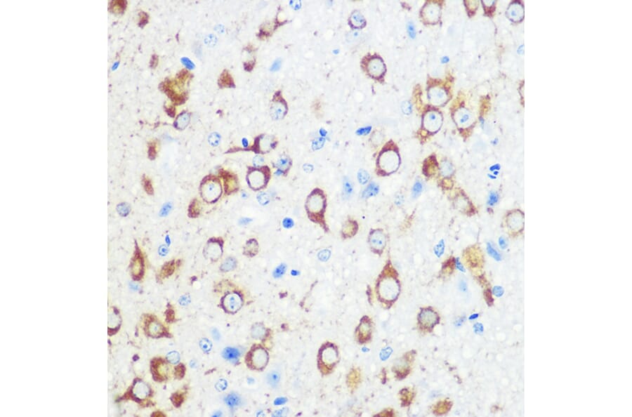 Immunohistochemistry - Anti-Mint-1 Antibody (A305790) - Antibodies.com