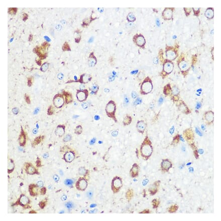 Immunohistochemistry - Anti-Mint-1 Antibody (A305790) - Antibodies.com