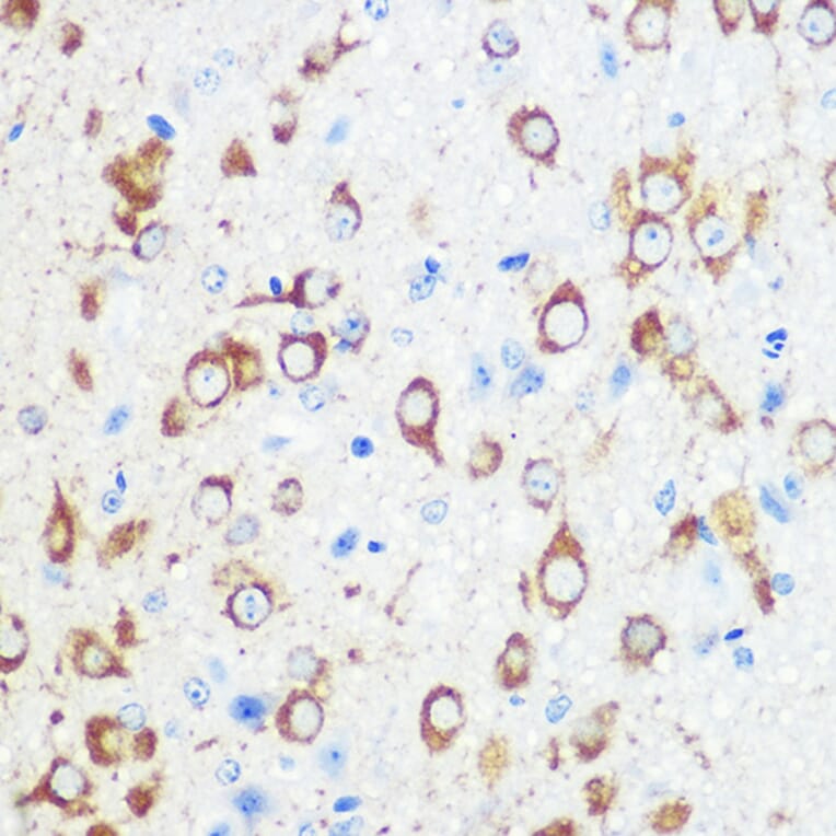 Immunohistochemistry - Anti-Mint-1 Antibody (A305790) - Antibodies.com