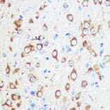 Immunohistochemistry - Anti-Mint-1 Antibody (A305790) - Antibodies.com