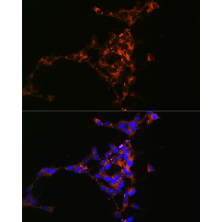 Immunofluorescence - Anti-Mint-1 Antibody (A305790) - Antibodies.com