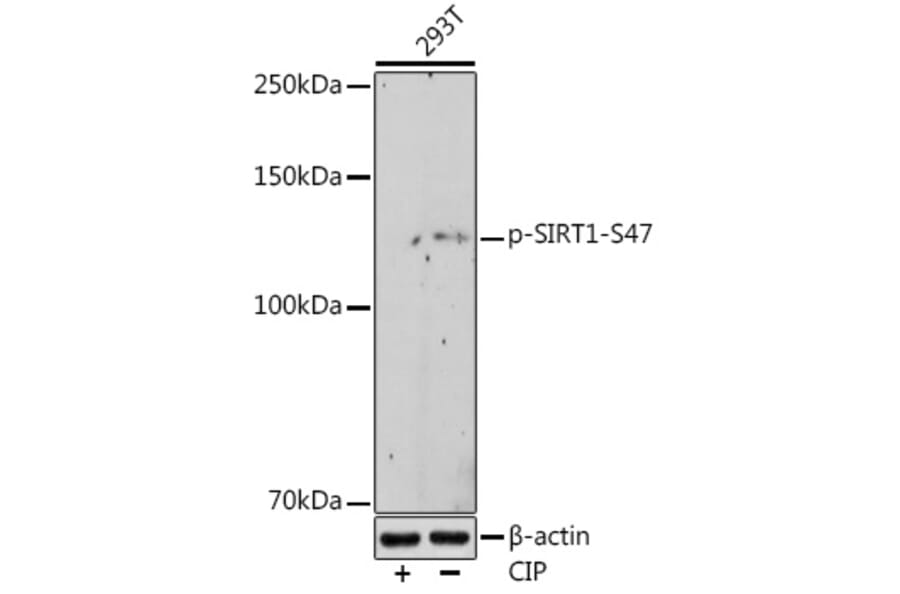 Western Blot - Anti-SIRT1 (phospho Ser47) Antibody [ARC1520] (A305791) - Antibodies.com