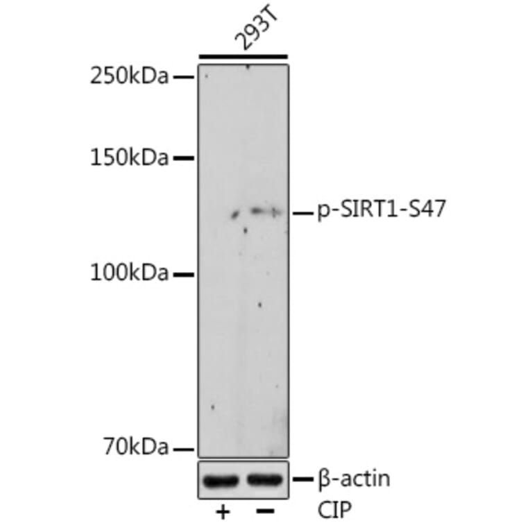 Western Blot - Anti-SIRT1 (phospho Ser47) Antibody [ARC1520] (A305791) - Antibodies.com