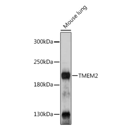 Western Blot - Anti-TMEM2 Antibody (A305792) - Antibodies.com